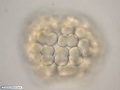 Embrião de bolacha-do-mar durante sétima clivagem