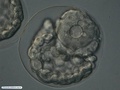 Embrião de bolacha-do-mar mal formado