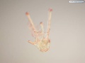 Larva plúteos de bolacha-do-mar com braço extra