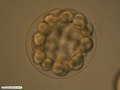 Embrião de bolacha-do-mar durante a sexta clivagem