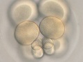 Embrião de bolacha-do-mar durante quarta clivagem