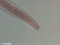 Nematoda