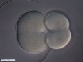 Segunda divisão celular de bolacha-do-mar