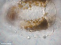 Hidrozoário colonial flutuante - detalhe da medusa evidenciando zooxantelas