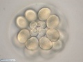 Embrião de bolacha-do-mar durante quinta clivagem