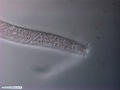 Nematoda